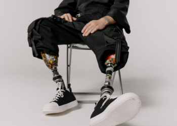 Kaki Palsu untuk Udin