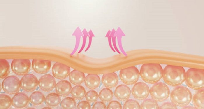 Berikut Beberapa Alasan Munculnya Jerawat dan Cara Mengatasinya