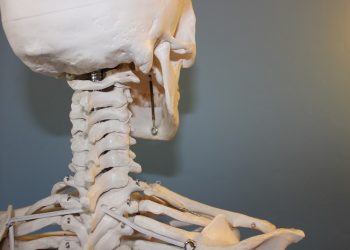 Berkenalan dengan Penyakit Spinal Cord Injury yang Diderita Laura Anna