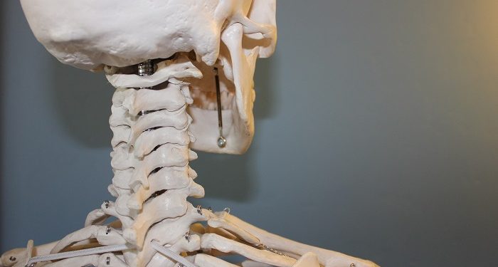 Berkenalan dengan Penyakit Spinal Cord Injury yang Diderita Laura Anna