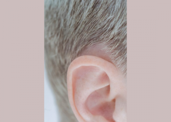 Mengenal Gejala Tinnitus, ketika Telinga Berdenging