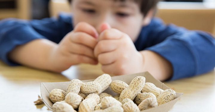 Menambahkan Kacang ke Makanan Anak Kecil Dapat Bantu Hindari Alergi