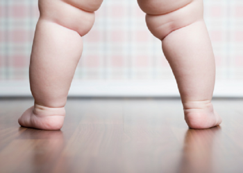 Balita Obesitas Berpotensi Mengalami Keterlambatan Mental