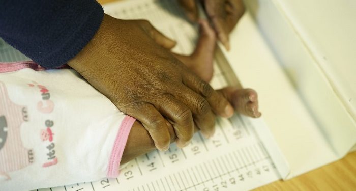 Hari Gizi Nasional 2022, Kemenkes Fokus Cegah Stunting dan Obesitas