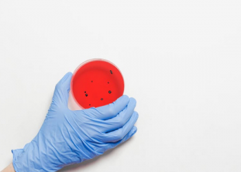 Kisah Umar bin Khattab Menghindari Tempat yang Penuh Wabah Penyakit