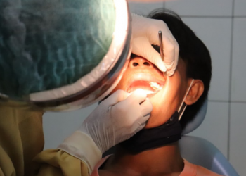 Kenali Gejala Kanker Rongga Mulut