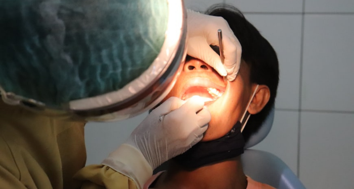 Kenali Gejala Kanker Rongga Mulut