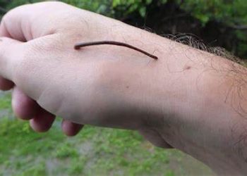 Sisi Lain dari Lintah