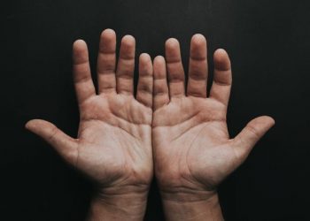 Kementerian Kesehatan Ungkap Cacar Monyet Bisa Sembuh Sendiri