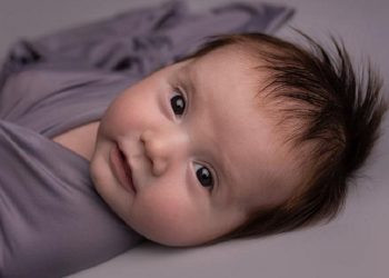 Mengapa Rambut Bayi Bisa Rontok?