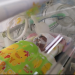 Bayi Kembar 4 Lahir di Bekasi dengan Selamat
