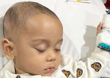 Anak Lesti Kejora Terkena Hernia Inguinalis, Kenali Penyebab dan Gejalanya