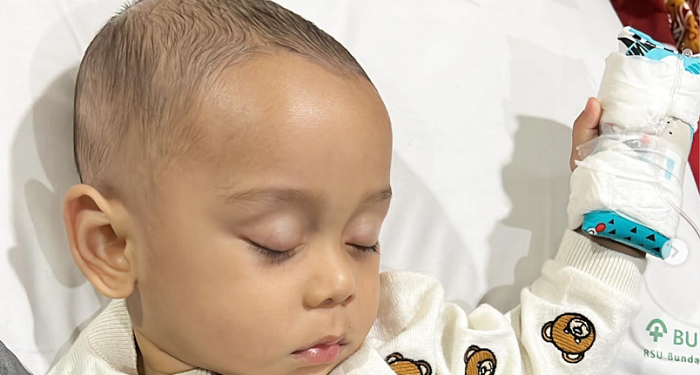 Anak Lesti Kejora Terkena Hernia Inguinalis, Kenali Penyebab dan Gejalanya