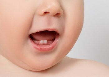 Fenomena Natal Teeth, Baru Lahir Sudah Punya Gigi