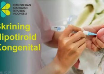 Skrining untuk Mencegah Kekurangan Hormon Tiroid pada Bayi