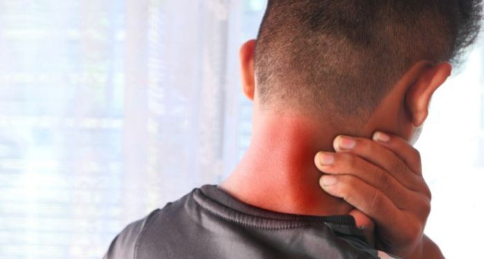 Cara mengatasi leher pegal dengan mudah