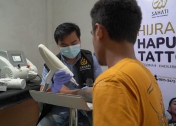 Mantap Hijrah, Puluhan Orang Berbondong Ingin Hapus Tato
