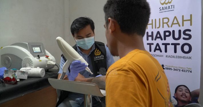 Mantap Hijrah, Puluhan Orang Berbondong Ingin Hapus Tato