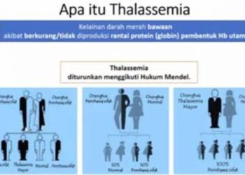 Thalassemia, hindari pernikahan sesama pembawa sifat