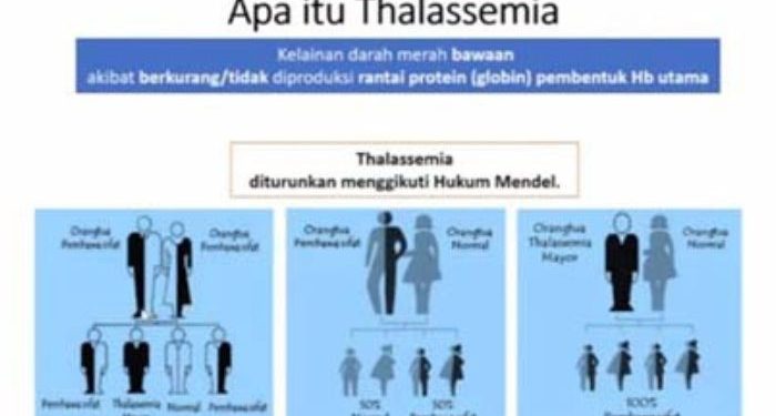 Thalassemia, hindari pernikahan sesama pembawa sifat