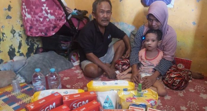 LAZ Al Azhar Salurkan Bantuan untuk Sohuca, Balita Penderita Radang Otak di Petamburan