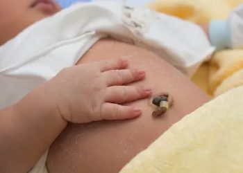 Tips Menjaga Tali Pusar Bayi Tetap Bersih dan Kering