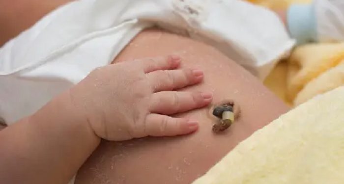 Tips Menjaga Tali Pusar Bayi Tetap Bersih dan Kering