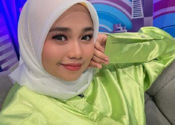 Selalu Cantik, Potret Aulia DA Tampil Berbagai Macam Outfit saat Manggung