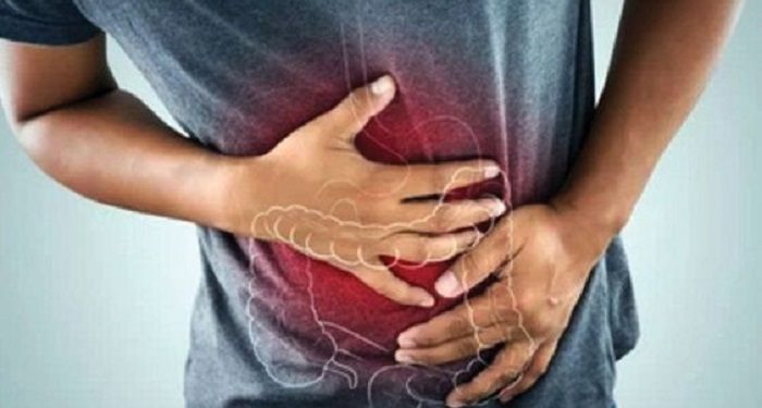 Solusi Membuang Lendir di Saluran Pencernaan dengan Resep Jurus Sehat Rasulullah (JSR)