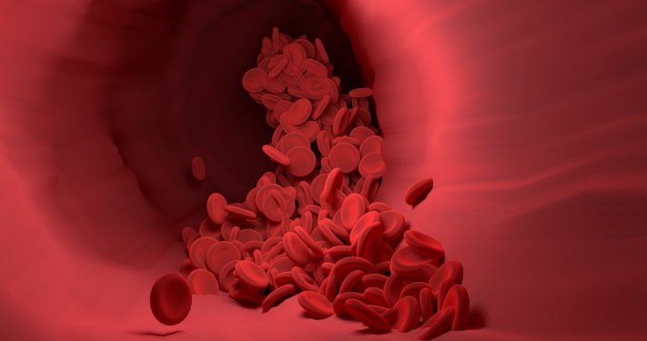 Memahami Gejala Penyakit Anemia, Ketahui Tanda-tanda dan Cara Mengatasinya
