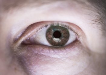 Ketahui, Mengucek Mata Terlalu Sering bisa Menimbulkan Kantung Mata