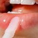 Cara Mudah dan Sederhana Melembapkan Bibir Secara Alami