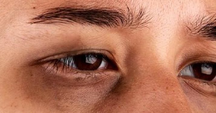 Dapat Mengurangi Kantung Mata, Beberapa Manfaat Memijat Wajah