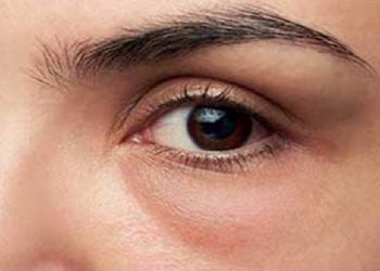 Lima Cara Pijat Wajah untuk Menghilangkan Kantung Mata