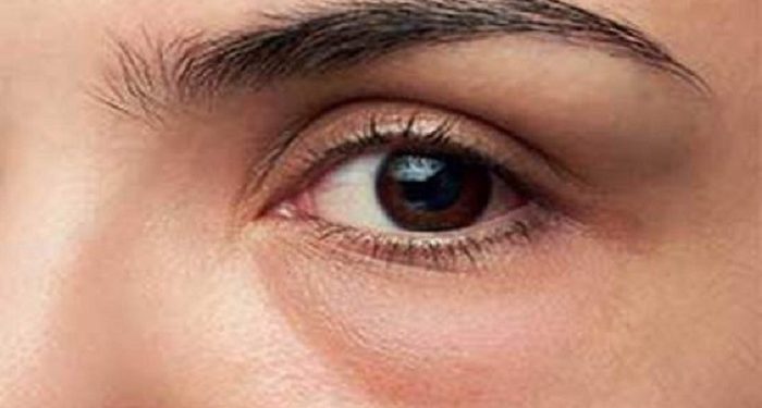 Lima Cara Pijat Wajah untuk Menghilangkan Kantung Mata