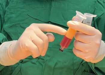 Fat Filler, Teknologi Treatment Kecantikan Terbaru dari dr. Ayu Widyaningrum