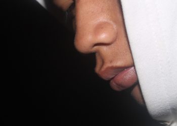 Bukan Perokok Aktif Tapi Bibir Hitam, Berikut Tujuh Penyebab Bibir Hitam