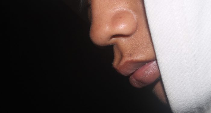 Bukan Perokok Aktif Tapi Bibir Hitam, Berikut Tujuh Penyebab Bibir Hitam