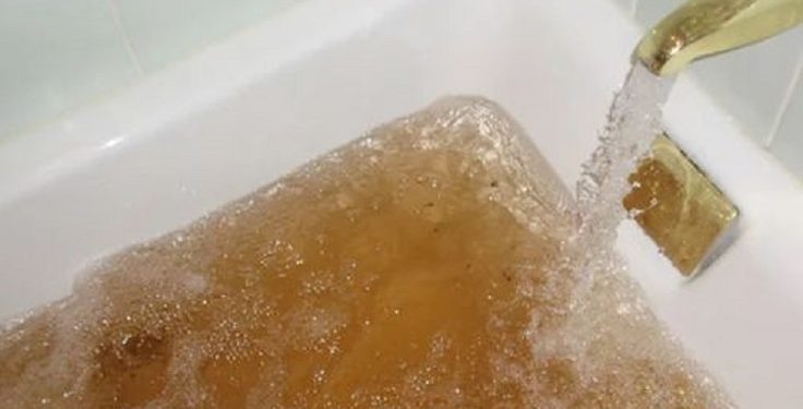 Ciri-Ciri Air yang Tidak Sehat untuk Kesehatan Kulit