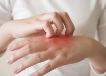 Cara Mengatasi Kulit Gatal di Malam Hari