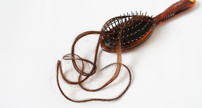 Simak Beberapa Faktor Risiko Rambut Rontok
