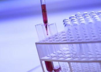 Halal Corner Jelaskan Hukum Perawatan Kulit Wajah dengan Plasma Darah