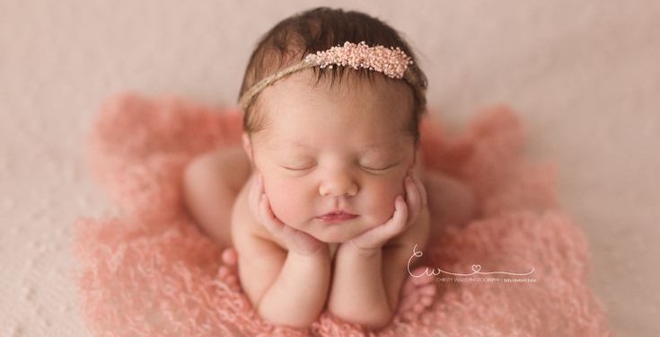 Bayi Kuning, Normalkah?