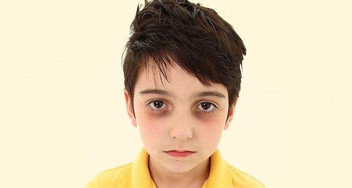 Tanda-Tanda Tubuh Ketika Kurang Tidur