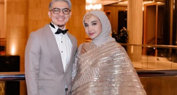 Miliki Tampilan Baru, Irwansyah Terlihat Gagah dan Penuh Pesona