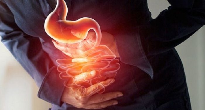 Stres Bisa Sebabkan Asam Lambung Naik, Simak Penjelasannya Berikut