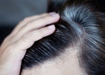 Beberapa Penyebab Munculnya Uban di Usia Muda