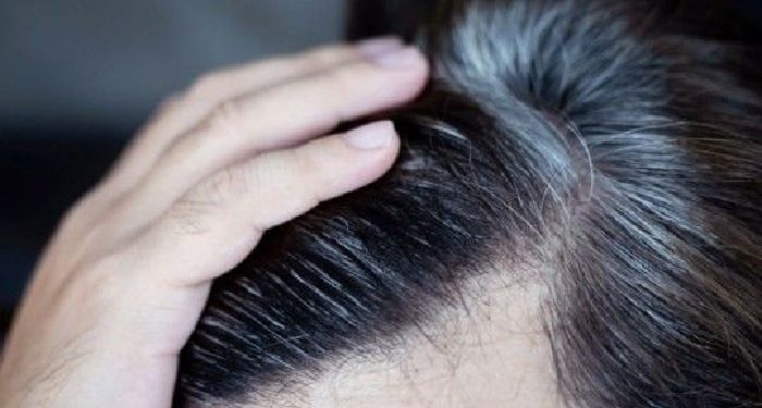 Beberapa Penyebab Munculnya Uban di Usia Muda