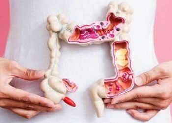 Kanker Kolorektal Umumnya Terjadi pada Orang Lanjut Usia