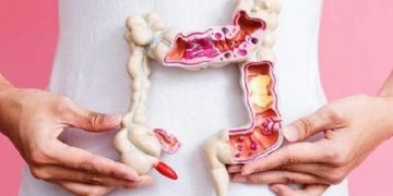 Kanker Kolorektal Umumnya Terjadi pada Orang Lanjut Usia